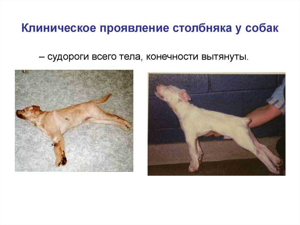 Психогенные неэпилептические приступы. что делать?