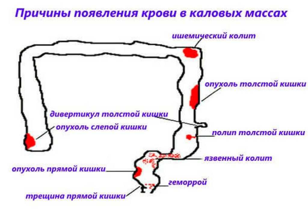 Котенок вытирает попу об пол что делать. причины, по которым кошка ездит на попе и катается на спине. почему котенок ездит на попе после туалета и чем помочь в домашних условиях