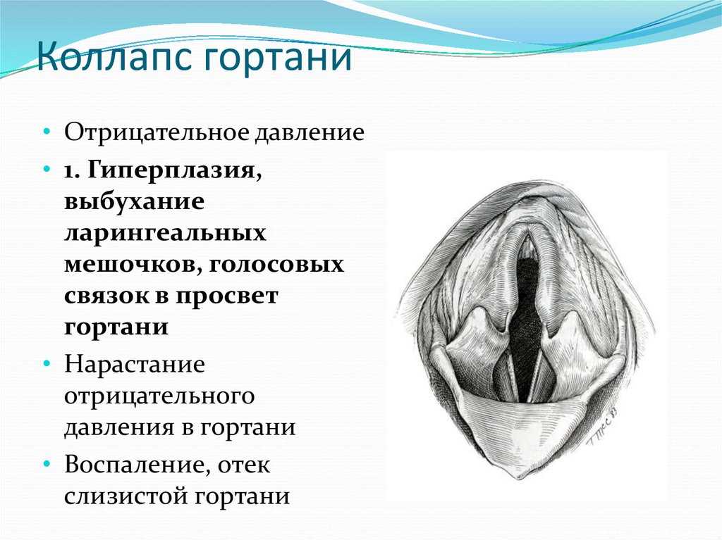 Паралич гортани у животных. отек гортани у собаки: причины, симптомы и лечение