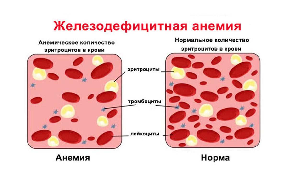 Анемия у собак: признаки, симптомы и лечение болезни