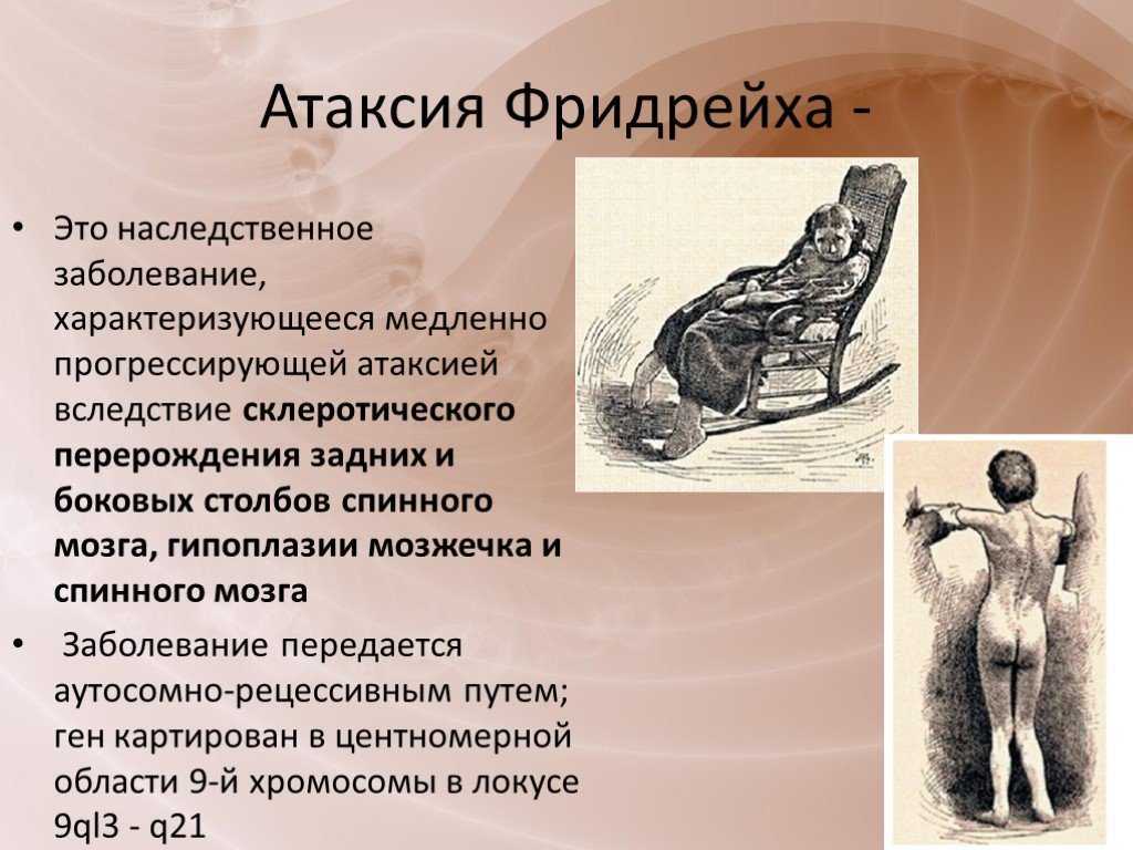 Атаксия – нарушение координации движений у кошек