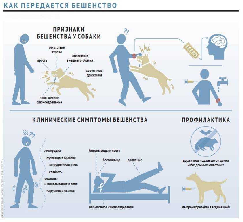 Параличи, парезы