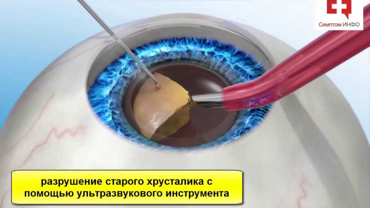 Как помочь собаке с катарактой: 11 шагов
