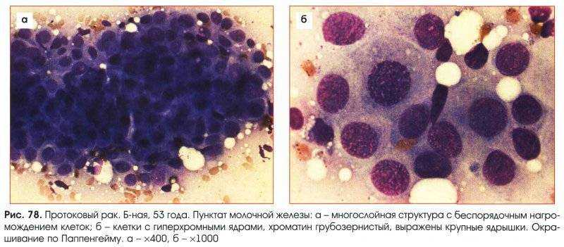 Цитологическое исследование